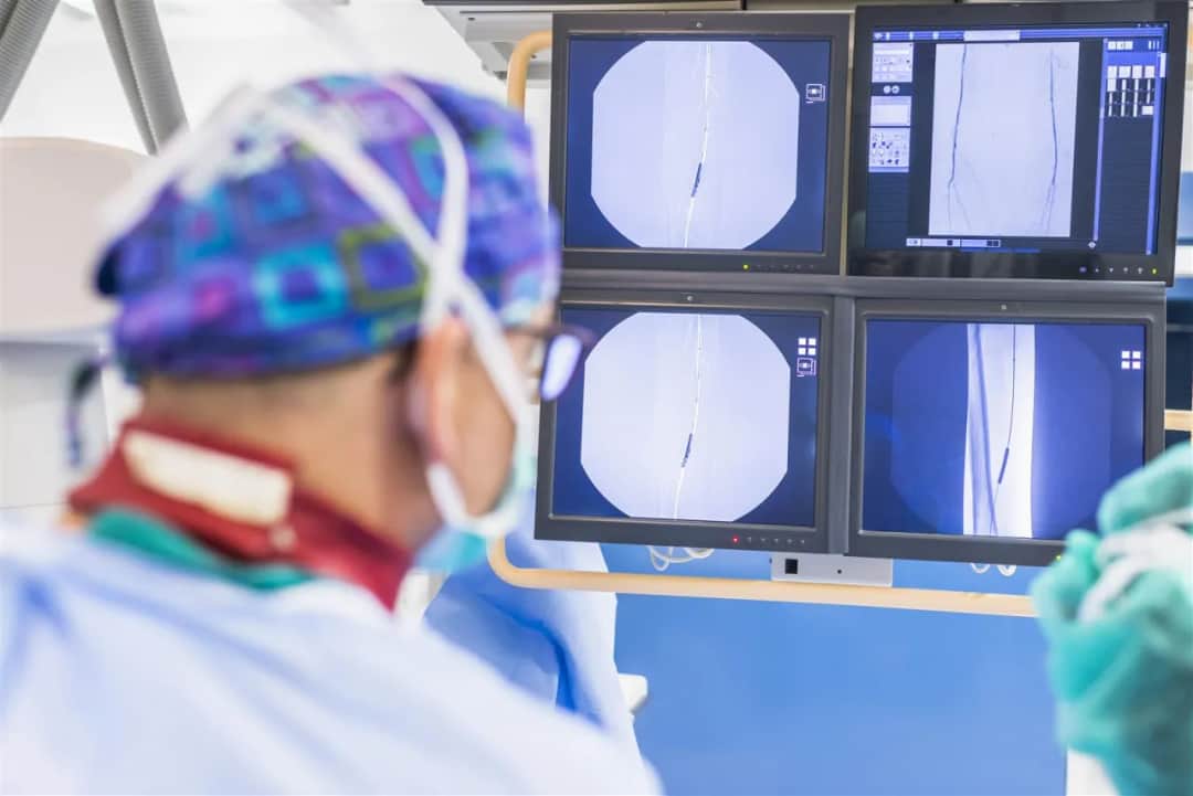 Przygotowanie do zabiegów chirurgii naczyniowej – co warto wiedzieć?