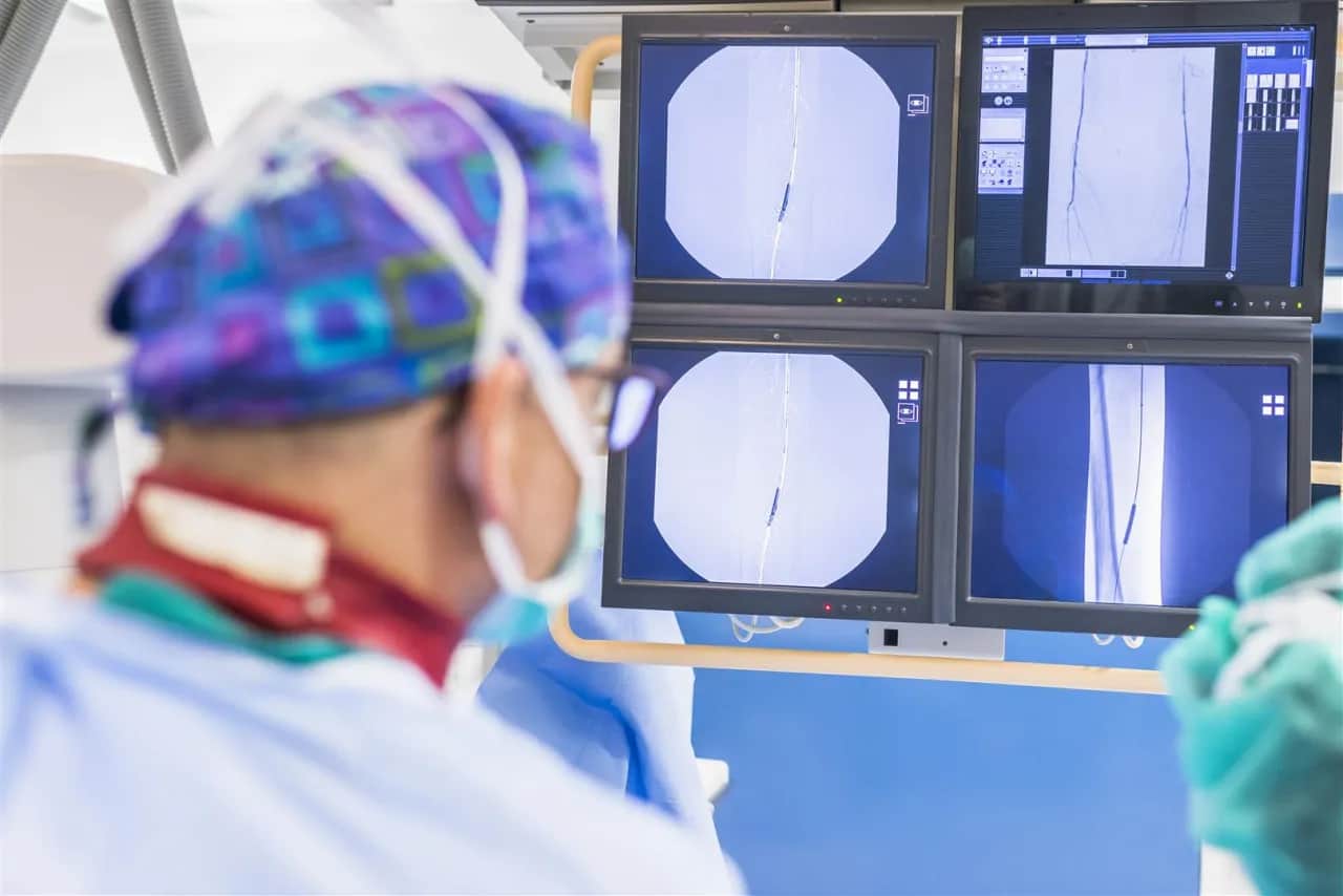 Przygotowanie do zabiegów chirurgii naczyniowej – co warto wiedzieć?