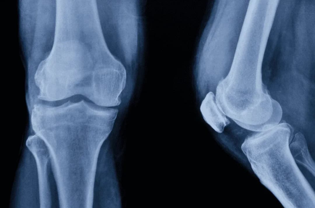 Anatomia kolana: Kompendium wiedzy o budowie i funkcjach